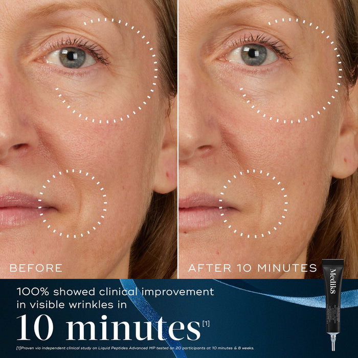 A before-and-after close-up of a participant's eye and mouth area, showing improvement in visible wrinkles after 10 minutes, highlighted by dotted circles. Text states "100% showed clinical improvement in visible wrinkles in 10 minutes." A Liquid Peptides Advanced MP deluxe sample is in the bottom right corner against a dark blue background with a blue ribbon.