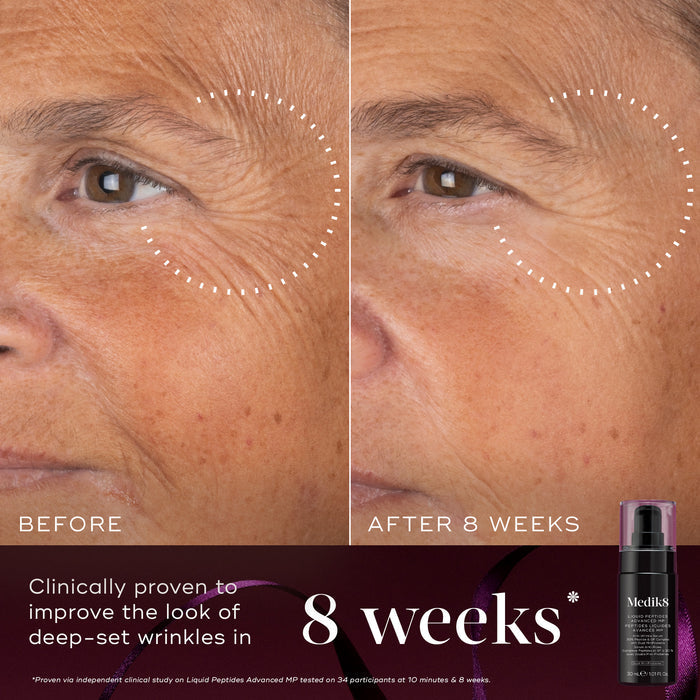 A before-and-after close-up of a participant's eye area over 8 weeks, demonstrating an improvement in deep-set wrinkles, highlighted by a dotted circle. Text states "Clinically proven to improve the look of deep-set wrinkles in 8 weeks." A Liquid Peptides Advanced MP black pump bottle sits in the bottom right corner against a burgundy background.