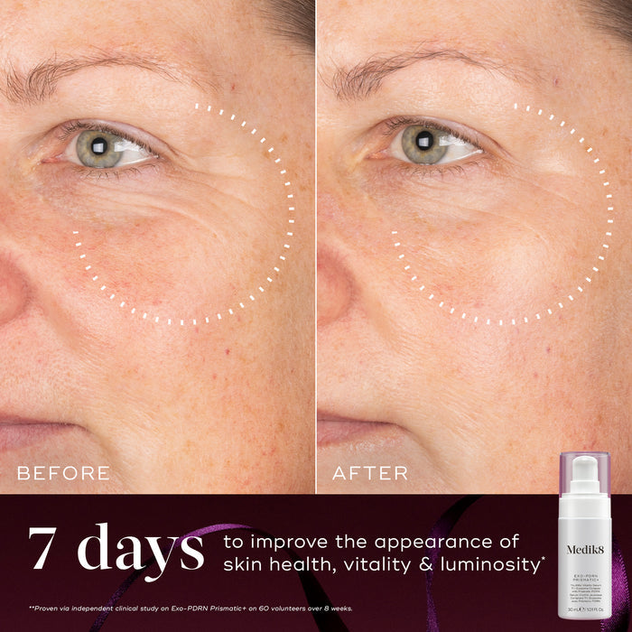 A before-and-after close-up of a participant's eye and cheek area over 7 days, showing improved skin tone and luminosity, highlighted by a dotted circle. Text states "7 days to improve the appearance of skin health, vitality & luminosity." An Exo-PDRN Prismatic+ white pump bottle is shown in the bottom right corner against a burgundy background.